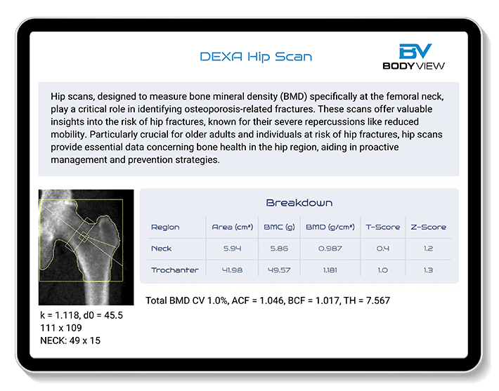 An example of our DEXA test results
