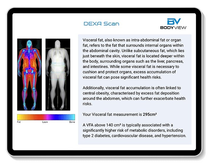 An example of our DEXA test results